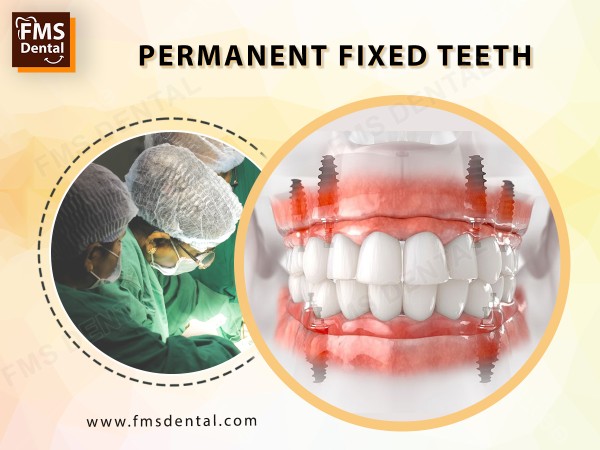 fix permanent teeth in just 5 days in hyderabad,fixed teeth in 5 days